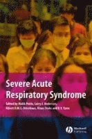 Severe Acute Respiratory Syndrome (inbunden)