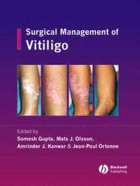 Surgical Management of Vitiligo (inbunden)