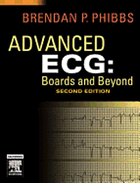 Advanced ECG: Boards and Beyond (inbunden)