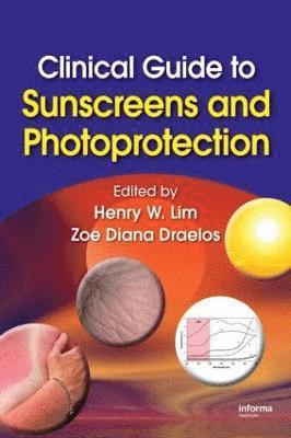 Clinical Guide to Sunscreens and Photoprotection (inbunden)