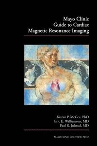 Mayo Clinic Guide to Cardiac Magnetic Resonance Imaging (hftad)