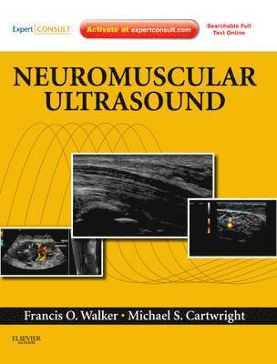 Neuromuscular Ultrasound (inbunden)