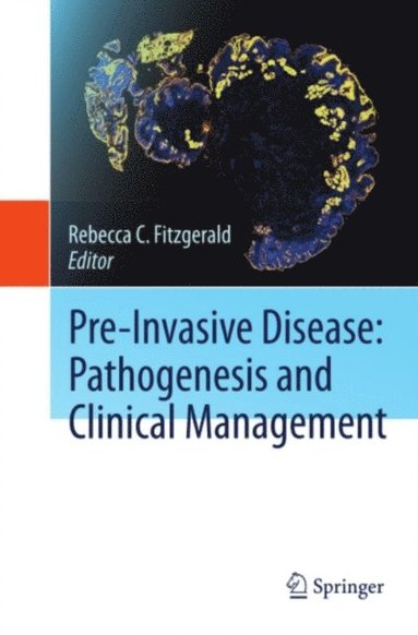 Pre-Invasive Disease: Pathogenesis and Clinical Management (e-bok)
