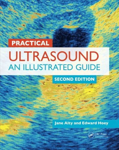 Practical Ultrasound (e-bok)
