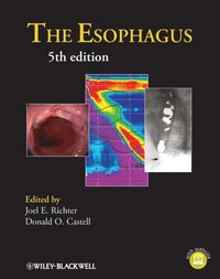 Esophagus (e-bok)