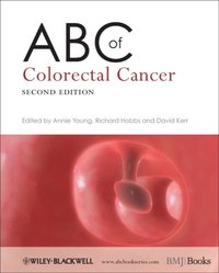 ABC of Colorectal Cancer (e-bok)