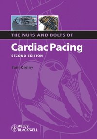 Nuts and Bolts of Cardiac Pacing (e-bok)