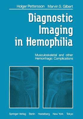 Diagnostic Imaging in Hemophilia (hftad)