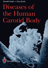 Diseases of the Human Carotid Body (e-bok)