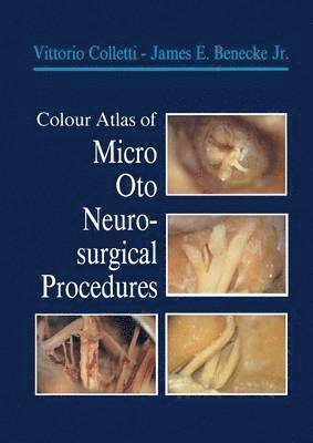 Colour Atlas of Micro-Oto-Neurosurgical Procedures (hftad)