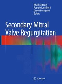 Secondary Mitral Valve Regurgitation (e-bok)
