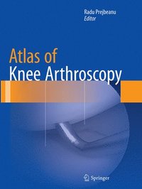 Atlas of Knee Arthroscopy (hftad)