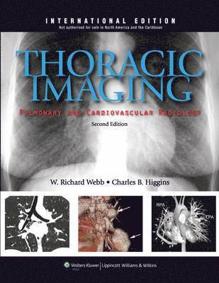 Thoracic Imaging: Pulmonary and Cardiovascular Radiology (häftad)