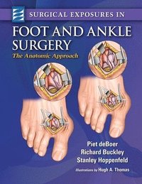 Surgical Exposures In Foot Ankle Surgery Piet Deboer - 