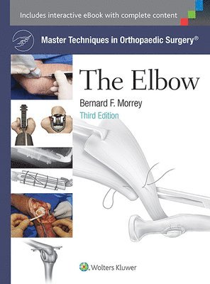 Master Techniques in Orthopaedic Surgery: The Elbow (inbunden)