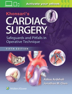 Khonsari's Cardiac Surgery: Safeguards and Pitfalls in Operative Technique (inbunden)