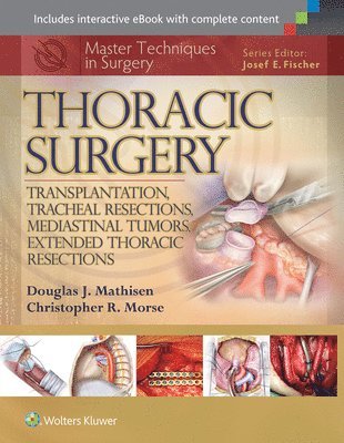 Master Techniques in Surgery: Thoracic Surgery: Transplantation, Tracheal Resections, Mediastinal Tumors, Extended Thoracic Resections (inbunden)
