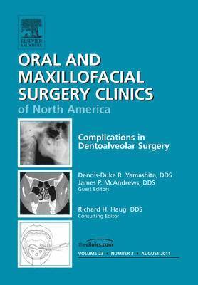 Complications in Dento-Alveolar Surgery, An Issue of Oral and Maxillofacial Surgery Clinics (inbunden)