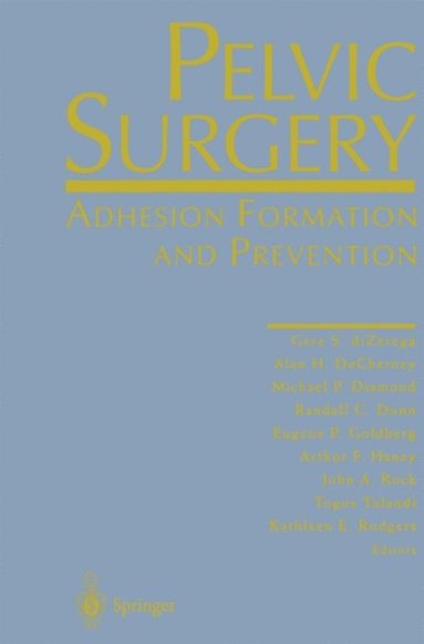 Pelvic Surgery (e-bok)