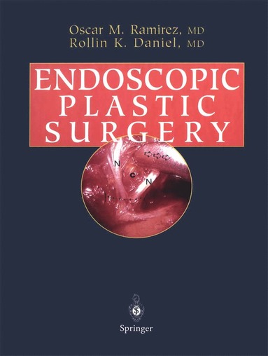 Endoscopic Plastic Surgery (inbunden)