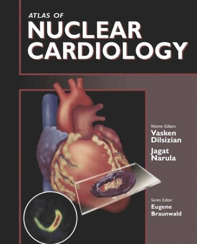 Atlas of Nuclear Cardiology (e-bok)
