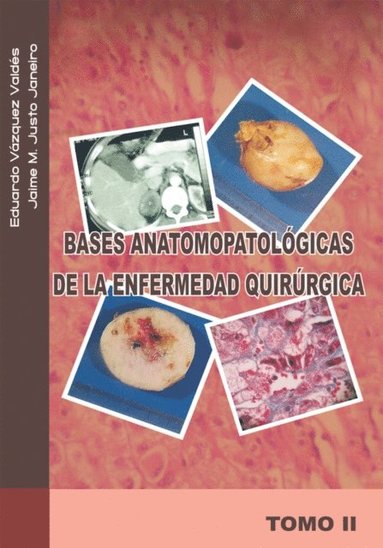 Bases Anatomopatológicas De La Enfermedad Quirúrgica (e-bok)
