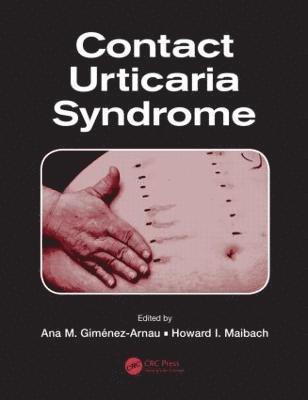 Contact Urticaria Syndrome (inbunden)