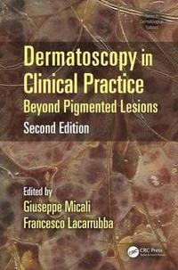 Dermatoscopy in Clinical Practice (inbunden)