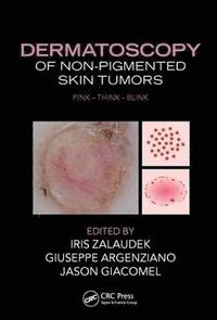 Dermatoscopy of Non-Pigmented Skin Tumors (inbunden)