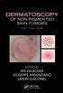 Dermatoscopy of Non-Pigmented Skin Tumors