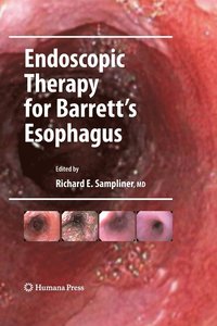 Endoscopic Therapy for Barrett's Esophagus (häftad)