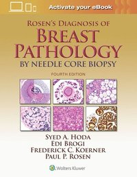 Rosen's Diagnosis of Breast Pathology by Needle Core Biopsy (inbunden)