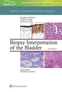 Biopsy Interpretation of the Bladder (inbunden)