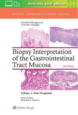 Biopsy Interpretation of the Gastrointestinal Tract Mucosa: Volume 1: Non-Neoplastic (inbunden)