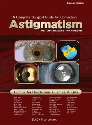 Complete Surgical Guide for Correcting Astigmatism - Bonnie An