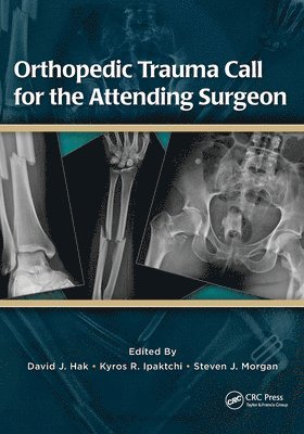 Orthopedic Trauma Call for the Attending Surgeon (häftad)