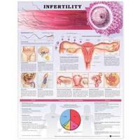 Infertility (inbunden)