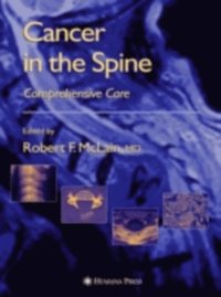 Cancer in the Spine (e-bok)