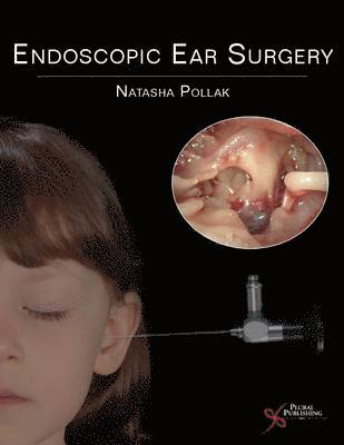 Endoscopic Ear Surgery (inbunden)