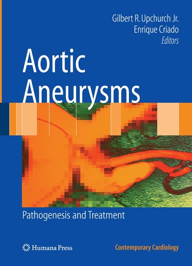 Aortic Aneurysms (inbunden)