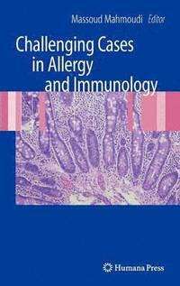 Challenging Cases in Allergy and Immunology (inbunden)