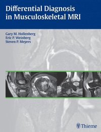 Differential Diagnosis in Musculoskeletal MRI (e-bok)