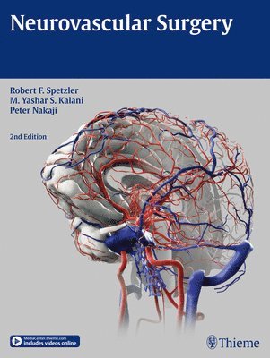 Neurovascular Surgery (inbunden)
