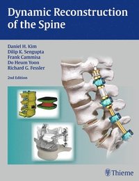 Dynamic Reconstruction of the Spine (inbunden)