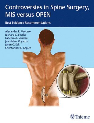 Controversies in Spine Surgery, MIS versus OPEN (inbunden)