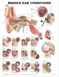 Middle Ear Conditions Anatomical Chart (inbunden)