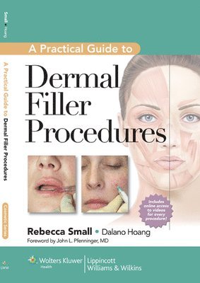 A Practical Guide to Dermal Filler Procedures (inbunden)
