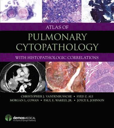 Atlas of Pulmonary Cytopathology (e-bok)