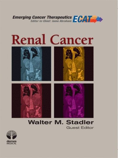 Renal Cancer (e-bok)