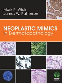 Neoplastic Mimics in Dermatopathology (e-bok)